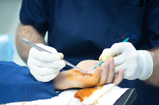 Hospital Universitário da UFSCar passa a oferecer cirurgia das mãos em São Carlos